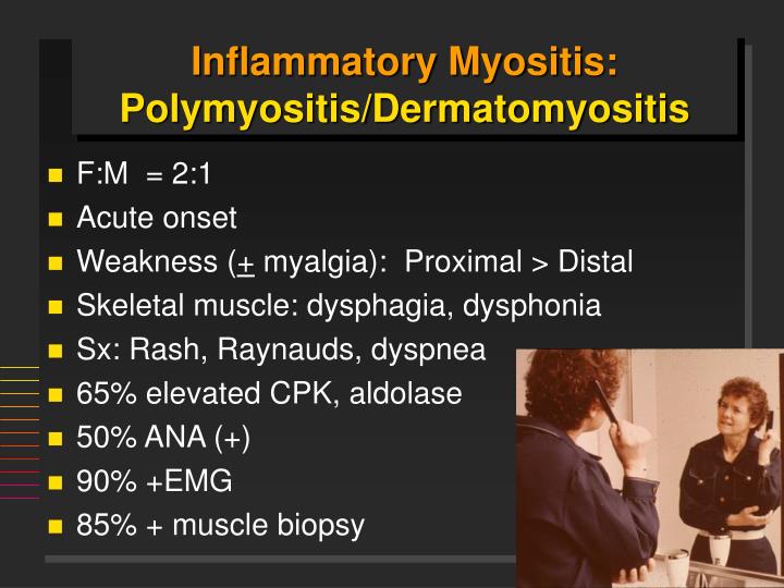 PPT - Scleroderma and Inflammatory Myositis PowerPoint Presentation ...