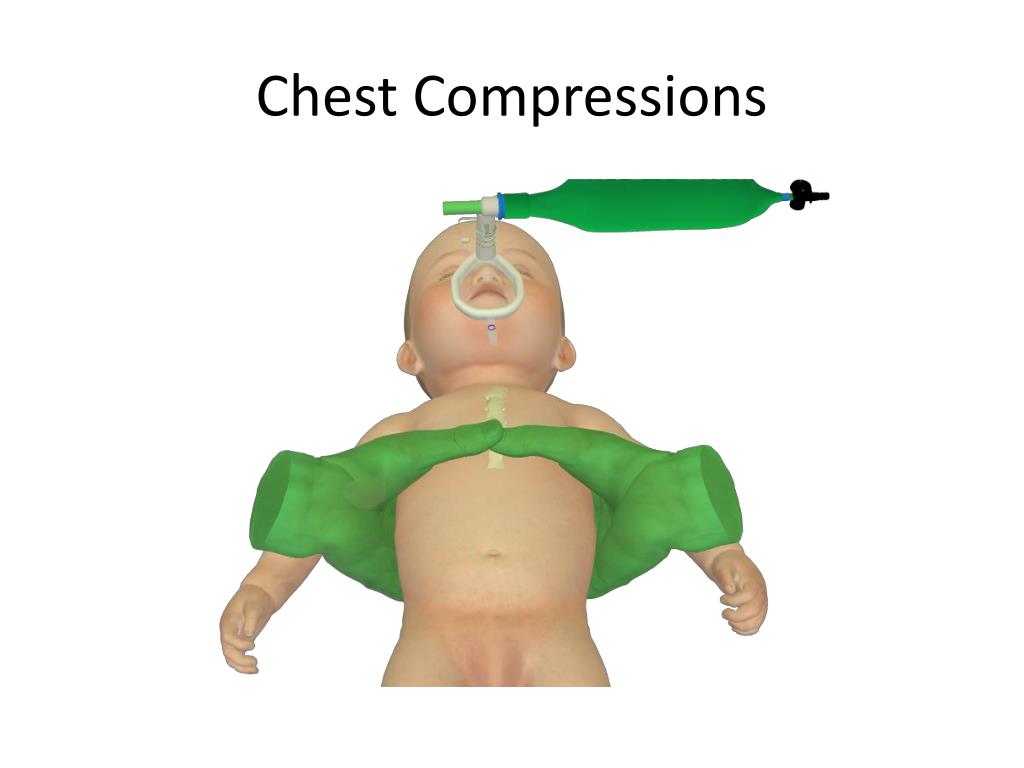 PPT Critical Concepts NICU PowerPoint Presentation, free download ID393882