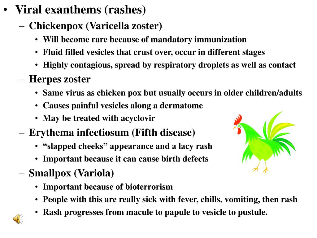 PPT - Chapter 40 Infectious Disorders PowerPoint ...