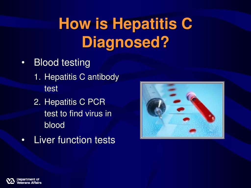 PPT to the Hepatitis C Education Class