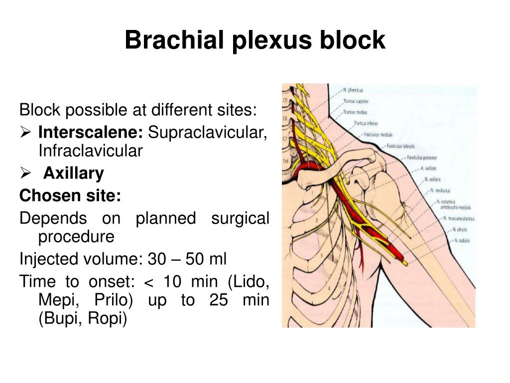 PPT - Local and regional anesthesia by dr. S. Bradulskis General ...