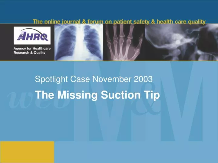 spotlight case november 2003 n.