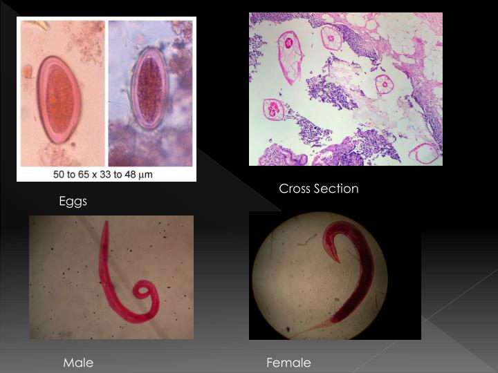 PPT - Enterobius vermicularis PowerPoint Presentation - ID:413096