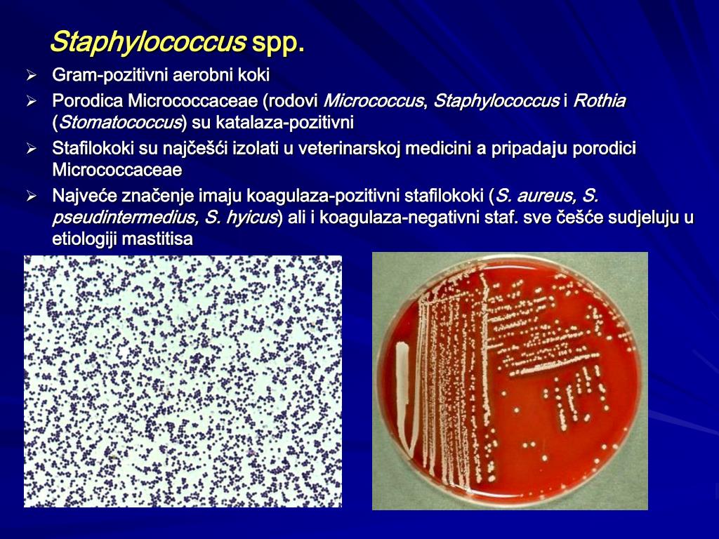 Staphylococcus aureus 3. Стафилококк SPP. Staphylococcus SPP что это. Staphylococcus SPP микробиология. Staphylococcus aureus и SPP.