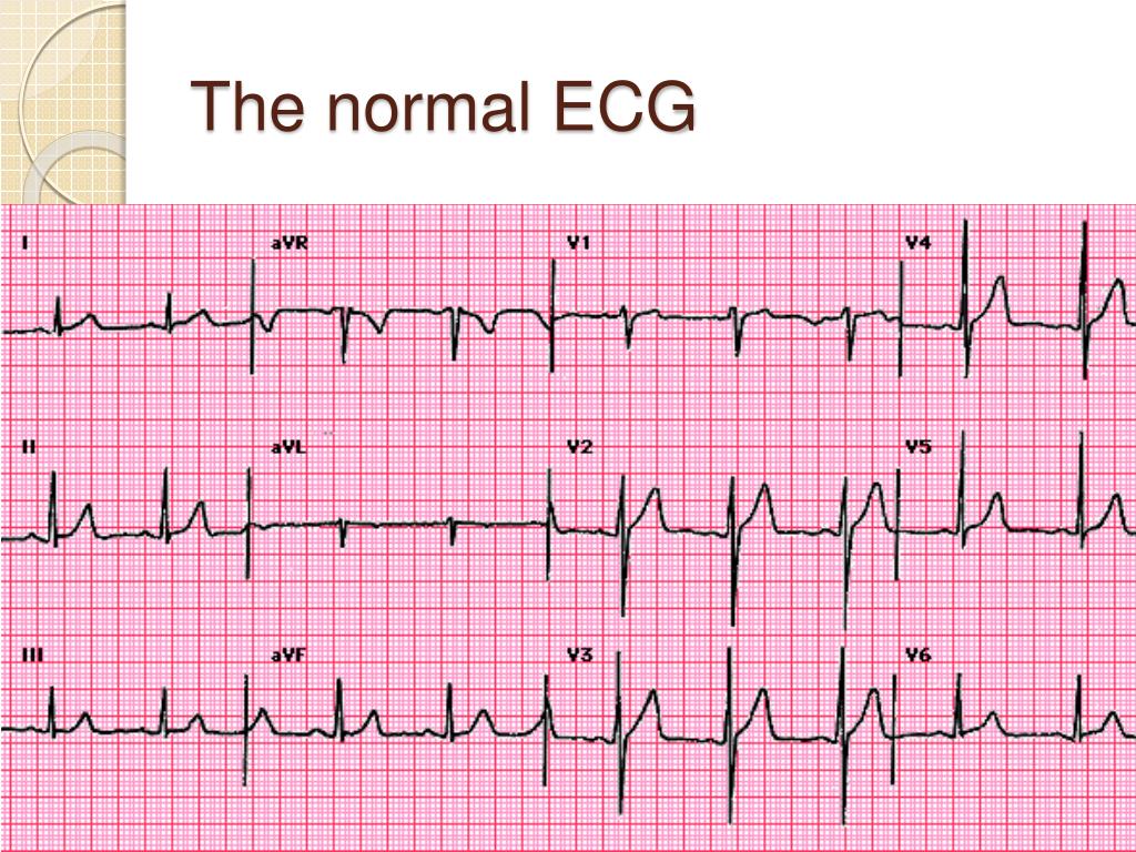 2. EKG Strip Nail Art - wide 3