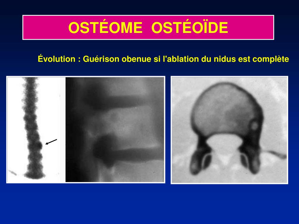 PPT OST OME OST O DE PowerPoint Presentation Free Download ID 423155