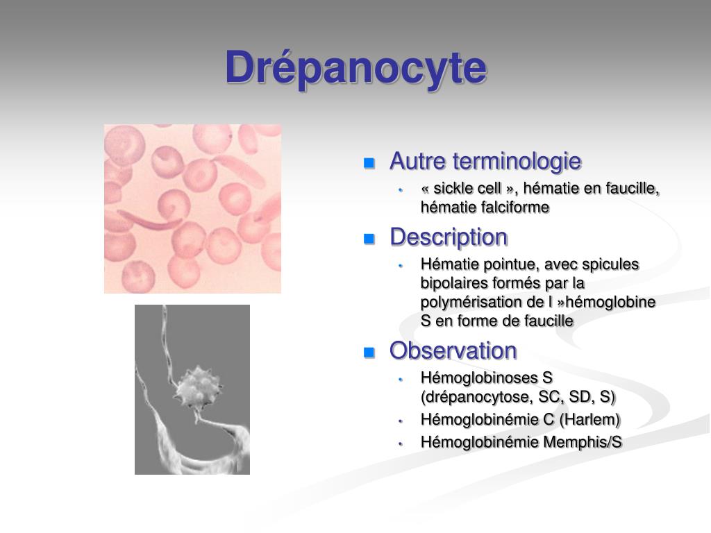 PPT MORPHOLOGIE DES HEMATIES Normales Et Pathologiques Viviane 