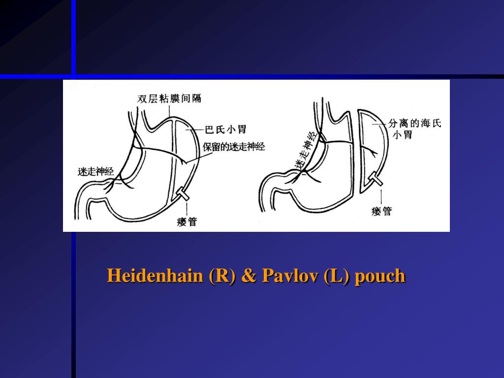 PPT Chapter 6 PowerPoint Presentation Free Download ID 428277