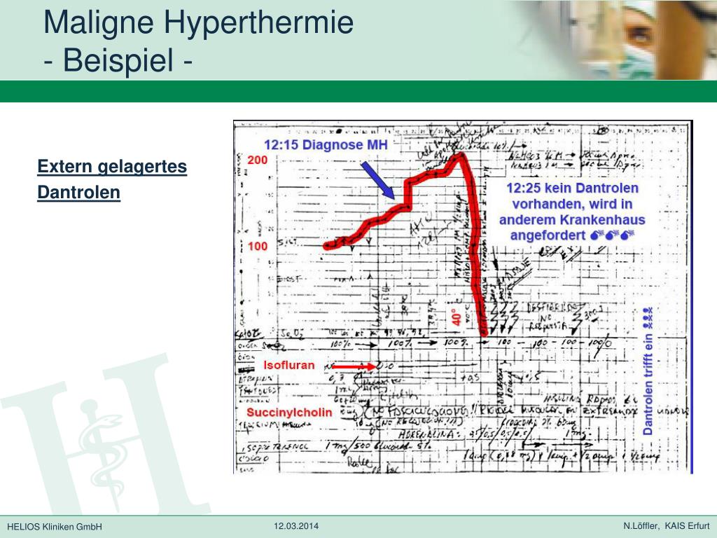 maligne ugly ppt powerpoint presentation beispiel extern löffler kais erfurt