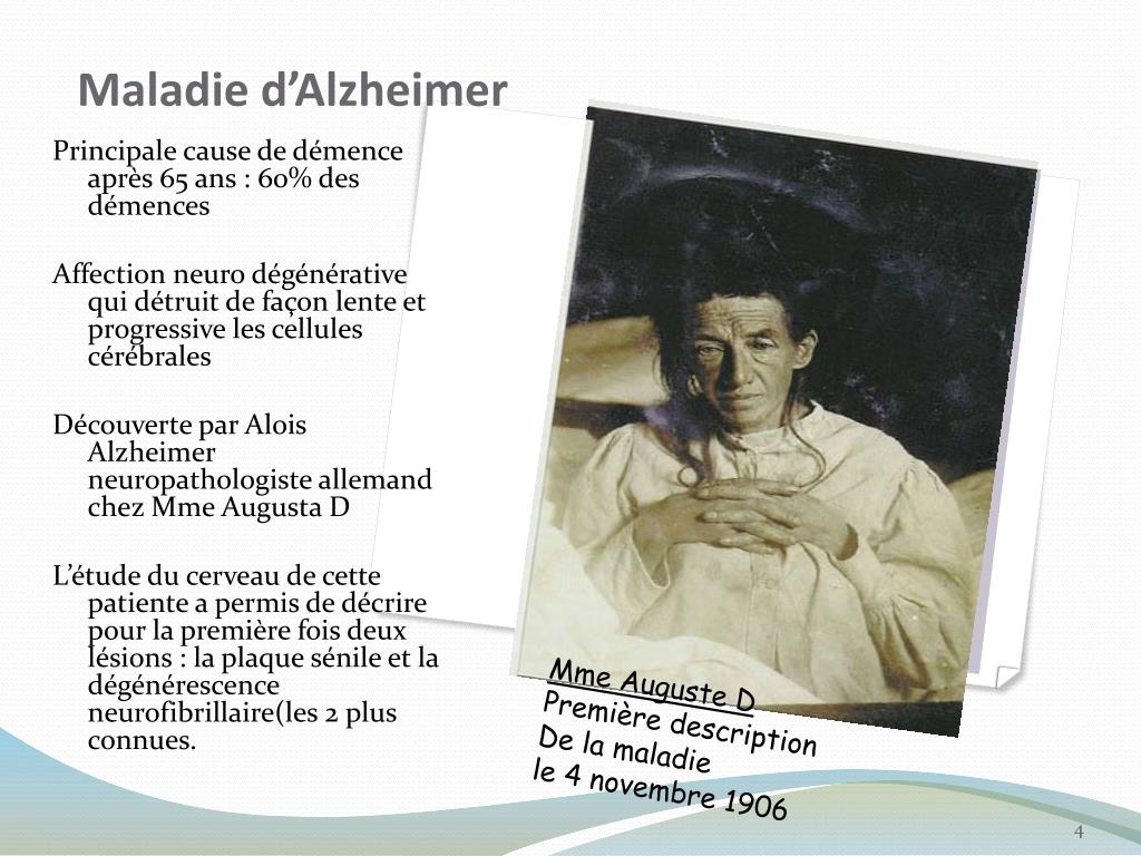 PPT - Les maladies de la mémoire diagnostic et prise en charge ...