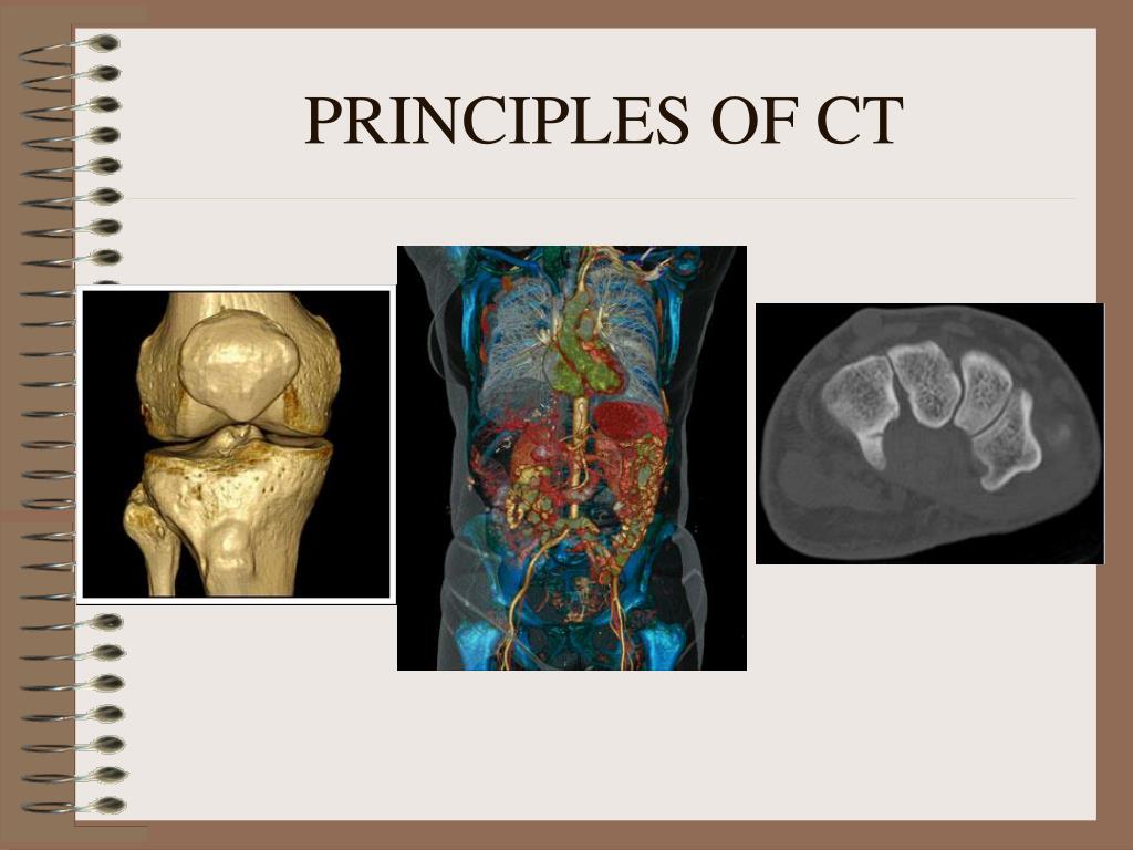 Basics Of Ct Scan Ppt Sumostory