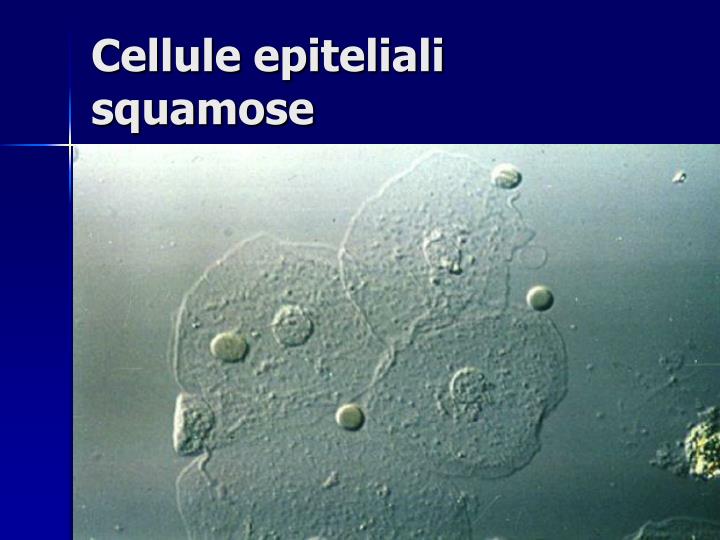 PPT - Esame delle urine PowerPoint Presentation - ID:445594