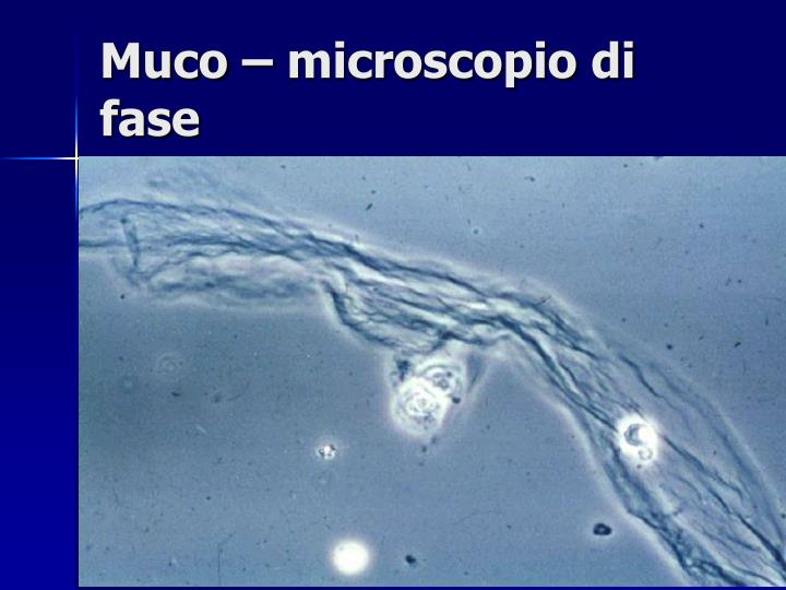 Strie Di Muco Nelle Urine