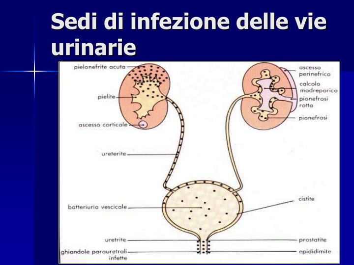 PPT Esame delle urine PowerPoint Presentation ID445594