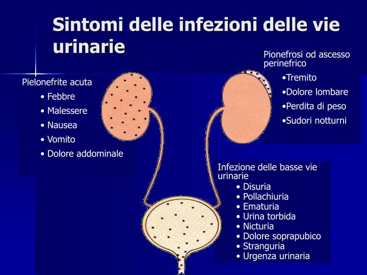 PPT Esame delle urine PowerPoint Presentation ID445594