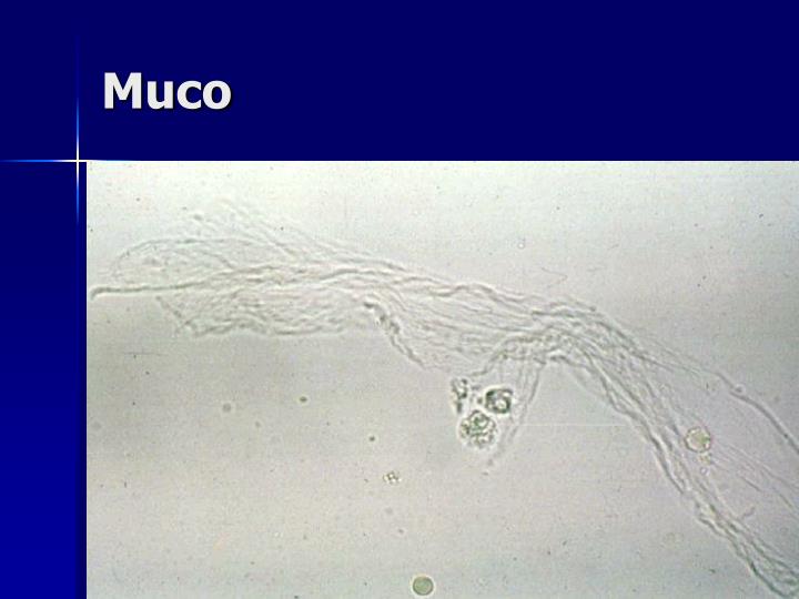 Strie Di Muco Nelle Urine