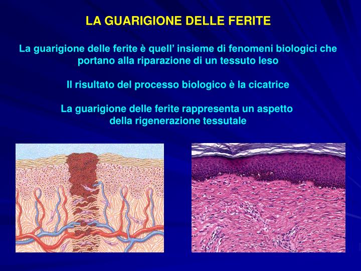 PPT - LE FERITE PowerPoint Presentation - ID:453288