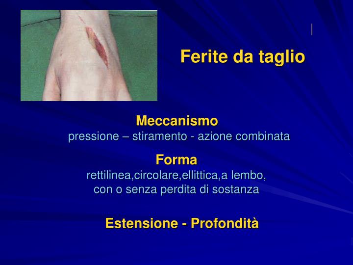 PPT LE FERITE PowerPoint Presentation ID 453288 PPT LE FERITE PowerPoint Presentation ID 453288