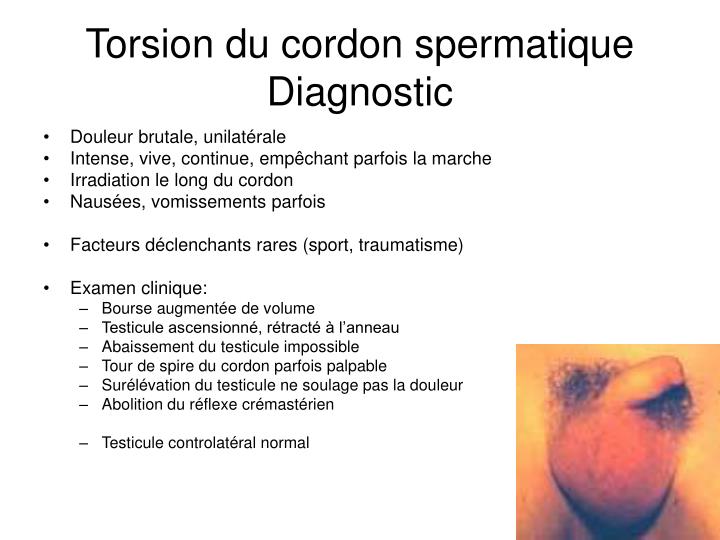 PPT Pathologies génitoscrotales PowerPoint Presentation ID456010