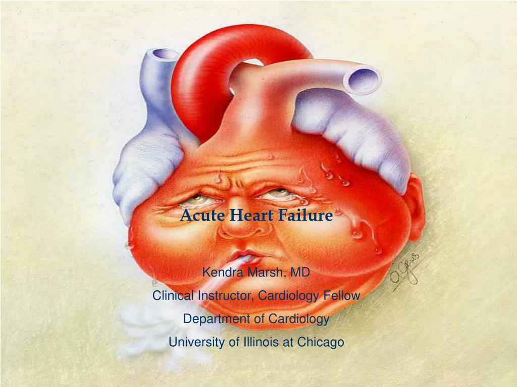 Ppt Acute Heart Failure Kendra Marsh Md Clinical Instructor