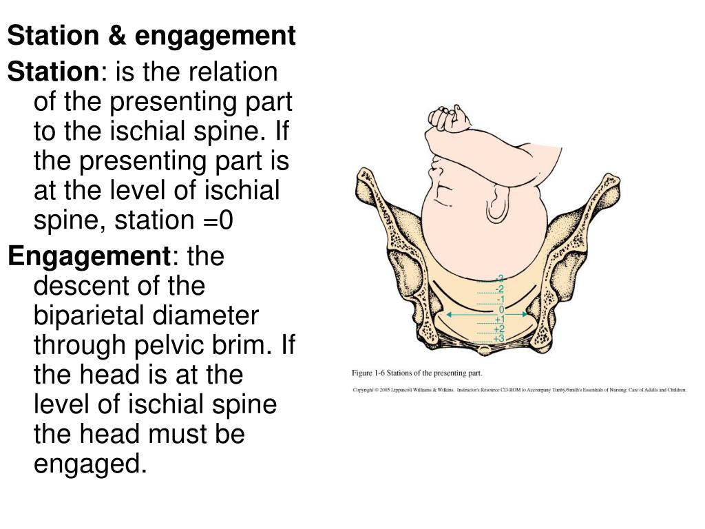 definition of presentation in obstetrics