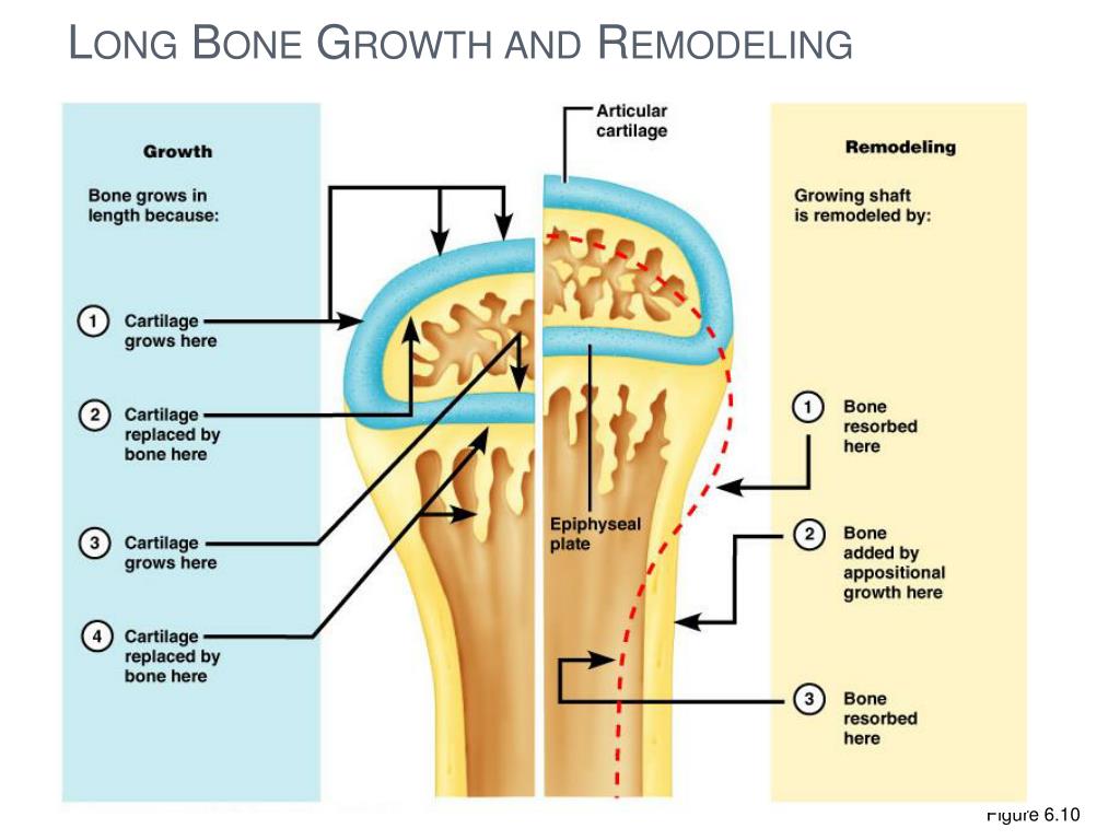 Long bone. Ростковая зона кости. Bone Zone of Transition. Long lesion long Bone. Bone Zone Damages.