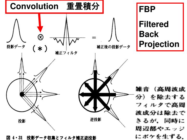 Ppt Spect Single Photon Emission Ct Pet Positron Emission Ct の原理 断層画像を得る方法 フィルタ重畳逆投影法 Fbp Filtered Back Pr Powerpoint Presentation Id 470399