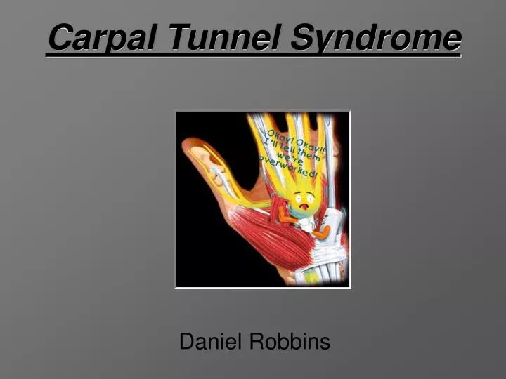 Ppt Carpal Tunnel Syndrome Powerpoint Presentation Free Download