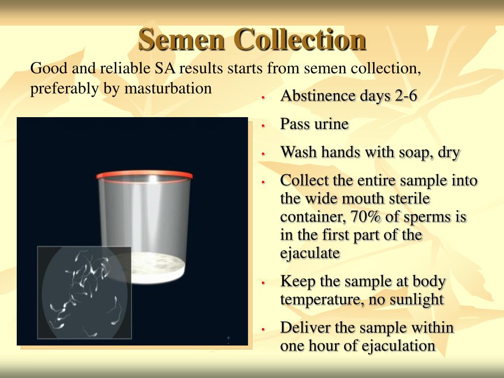 Semen. Semen collection. Семен semen. Semen Sample. Clinic semen collection.