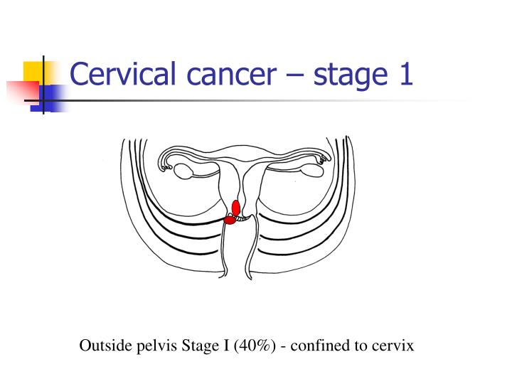 ppt-cytology-after-radical-trachelectomy-for-cervical-cancer