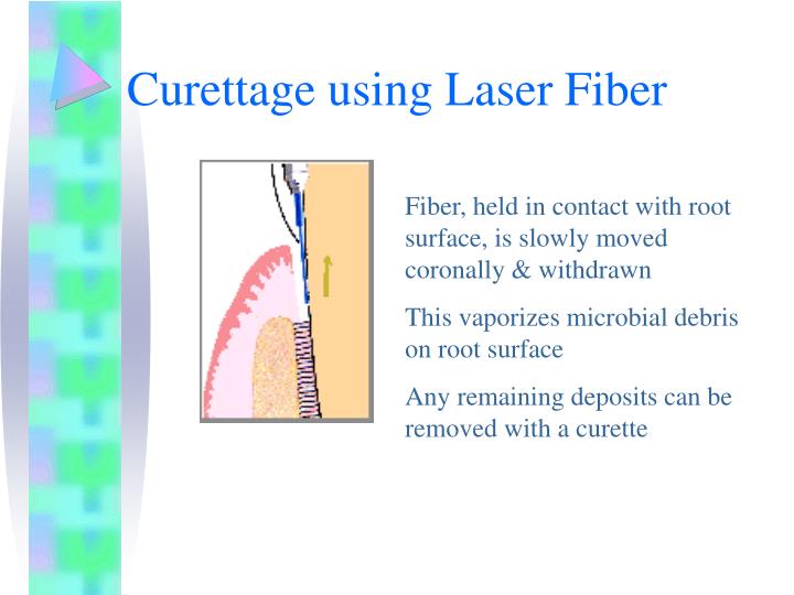 PPT Gingival Curettage PowerPoint Presentation ID479537
