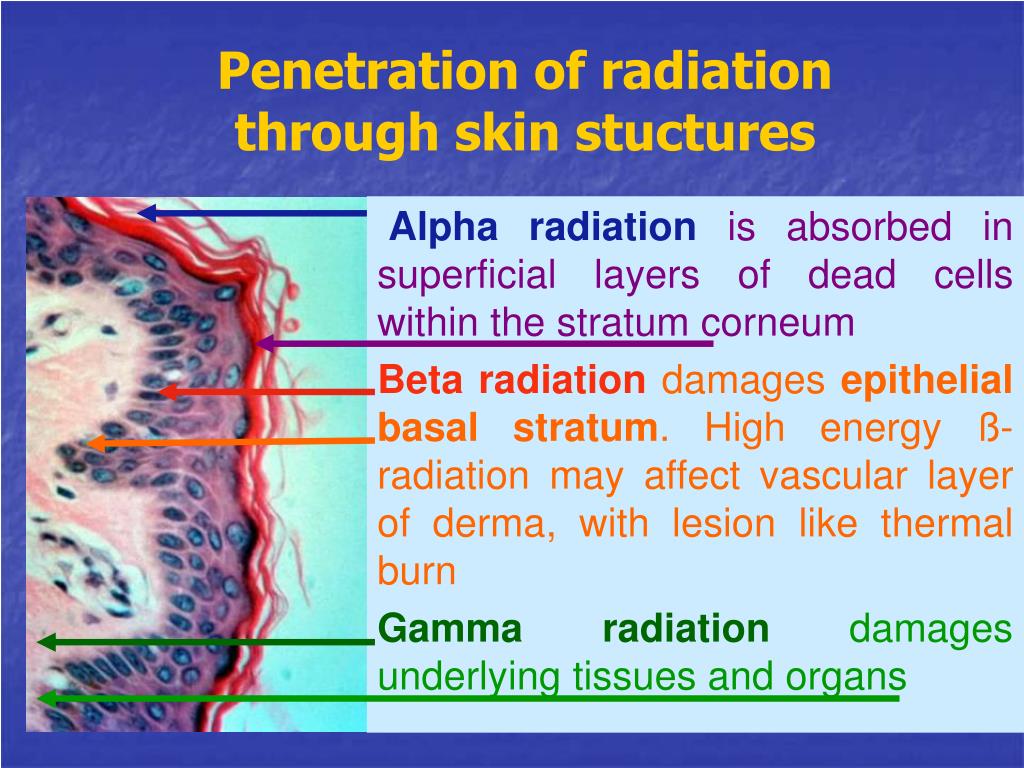 PPT - BIOLOGICAL EFFECTS OF IONIZING RADIATION ON T I SSUE S , ORGANS