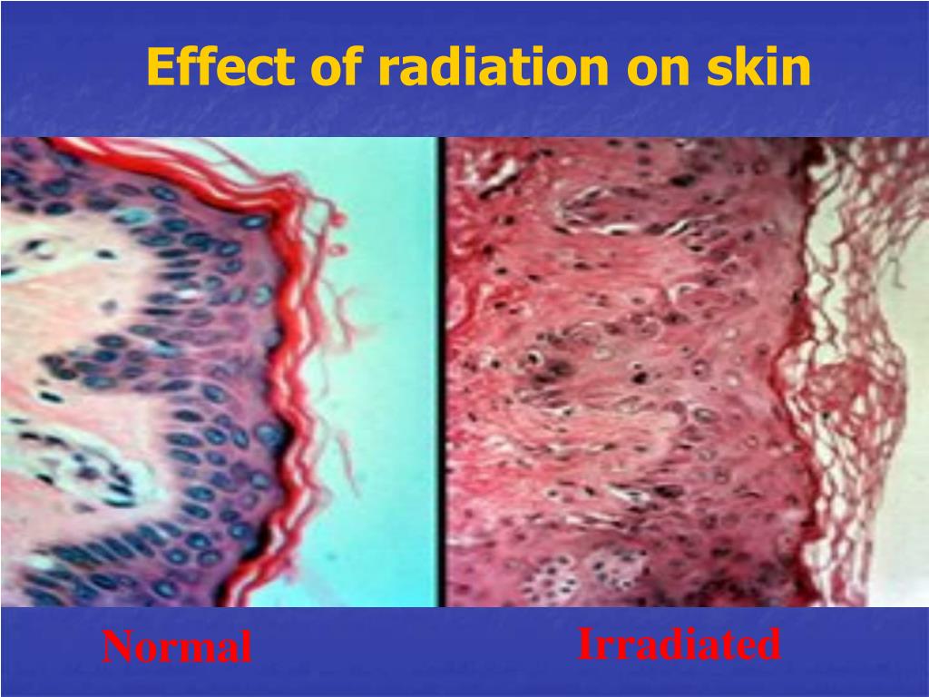 PPT - BIOLOGICAL EFFECTS OF IONIZING RADIATION ON T I SSUE S , ORGANS