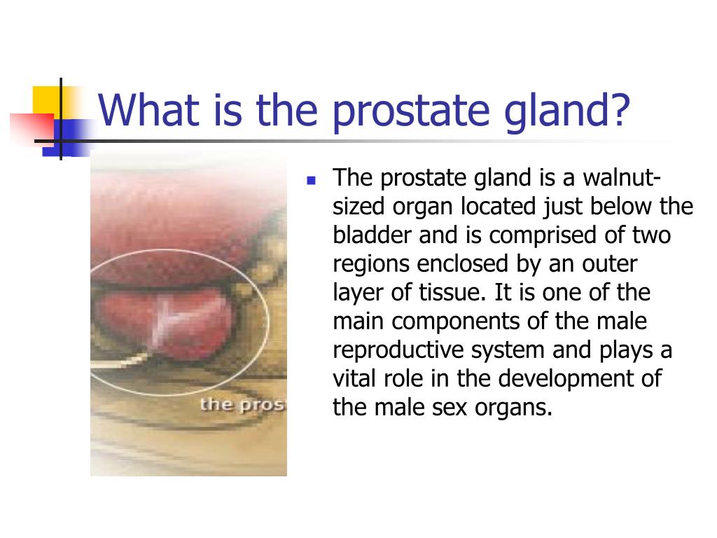 Ppt the prostate gland prostate cancer and brachytherapy powerpoint