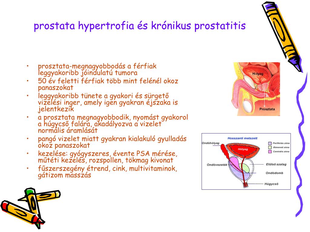 prostatitis a köszvénytől