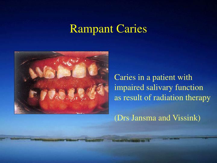 ppt clinical features diagnosis of dental caries powerpoint rampant caries