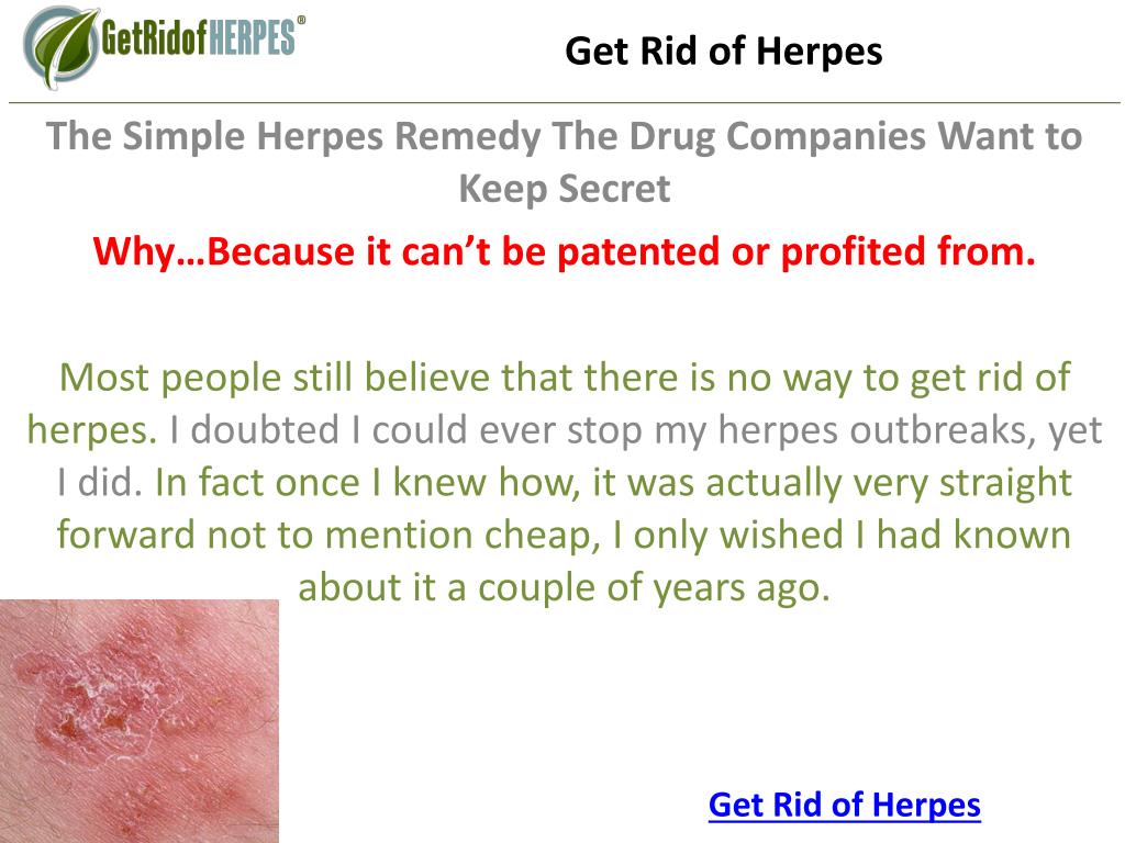 Get Rid of Herpes.