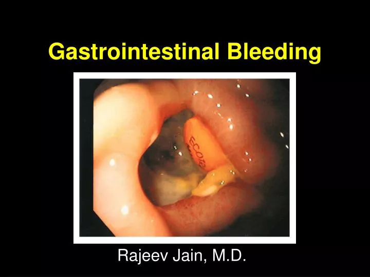 gastrointestinal bleeding n.