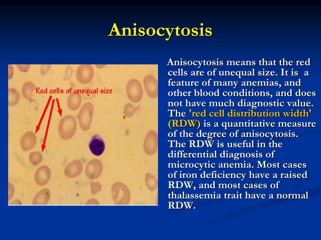 Анизоцитоз микро