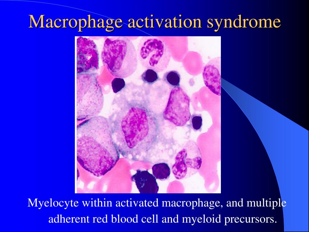 Эритроциты макрофаги. Макрофаги гистология. Синдром активации макрофагов. Активированные макрофаги. Моноциты и макрофаги.