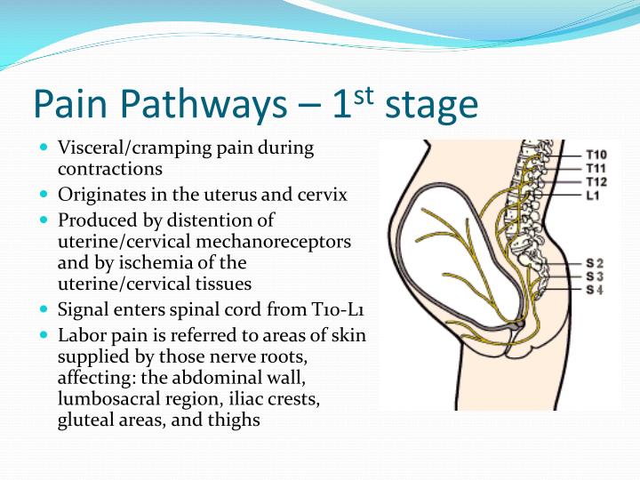 PPT Management of Labor Pain PowerPoint Presentation ID517055