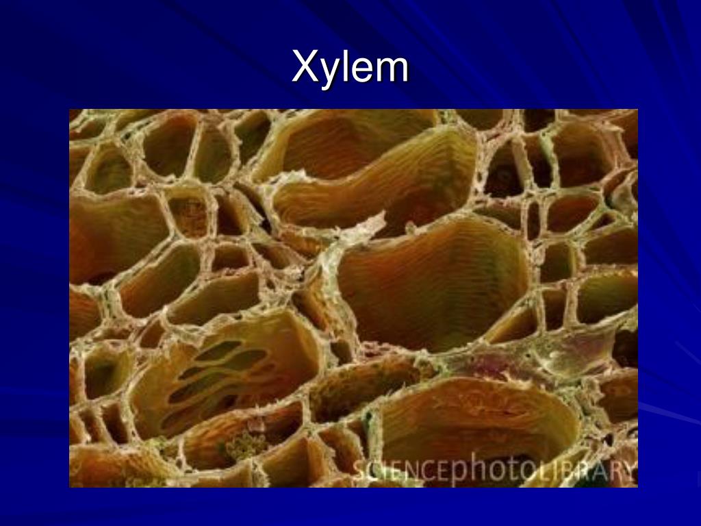 Механическая ткань растений сосуды. Ксилема микроскоп. Флоэма микрофотография. Сосуды ксилемы микрофотография. Ксилема корня микроскоп.
