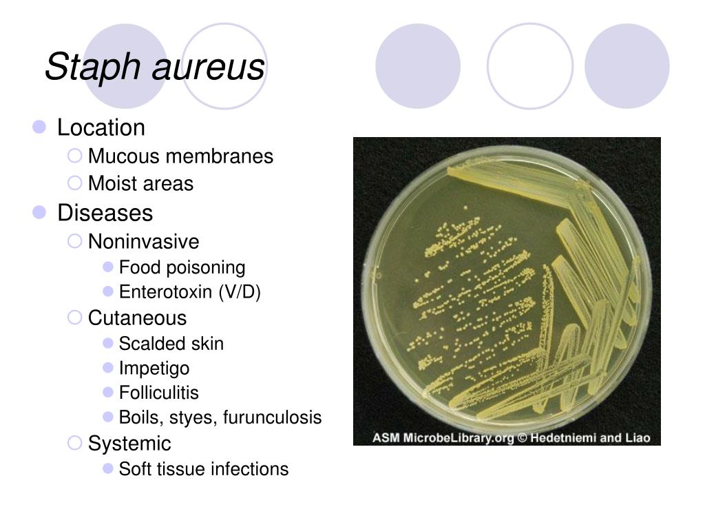 Staphylococcus aureus 10 3. Ауреус (aureus). S aureus форма. Результат на s.aureus.