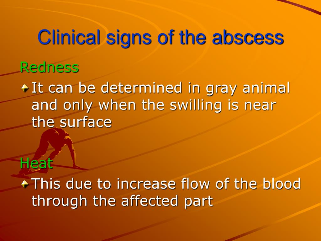PPT Abscess PowerPoint Presentation, free download ID523525