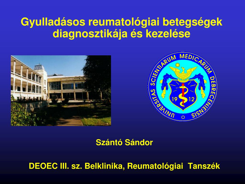 PPT - Gyulladásos reumatológiai betegségek diagnosztikája és kezelése  PowerPoint Presentation - ID:531507