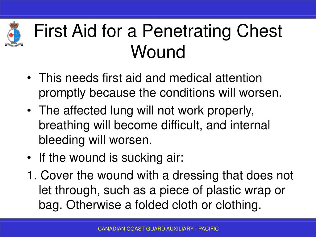 PPT - FIRST AID 3 - Breathing Emergencies PowerPoint Presentation, free  download - ID:539667
