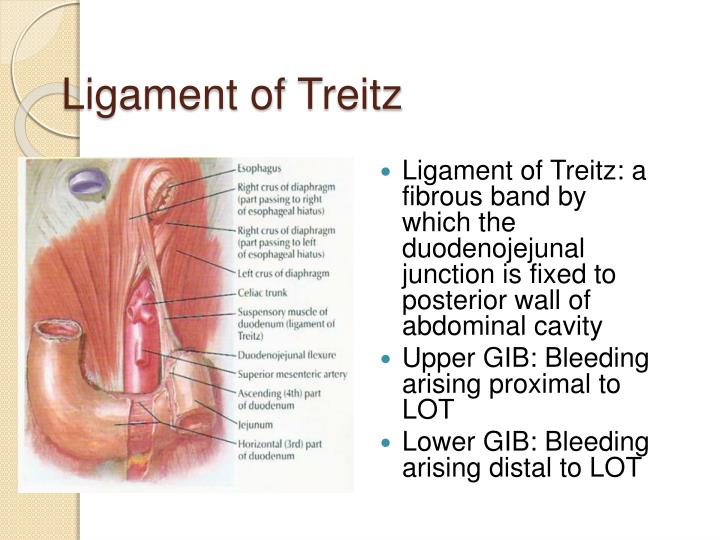 PPT Gastrointestinal Bleeding PowerPoint Presentation ID547157