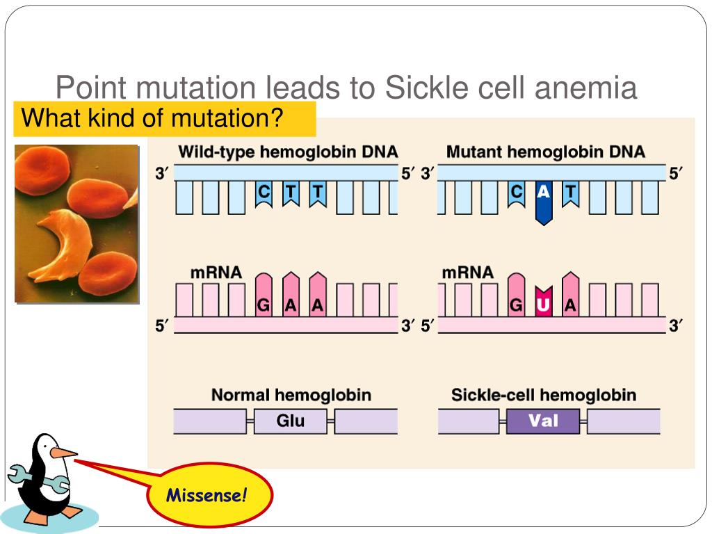 What Causes Sickle Cell Anemia Mutation