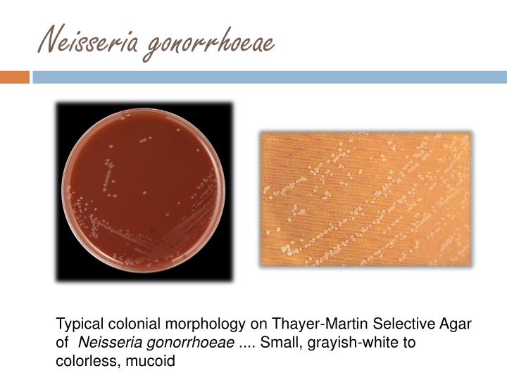PPT Thayer Martin agar PowerPoint Presentation ID554606