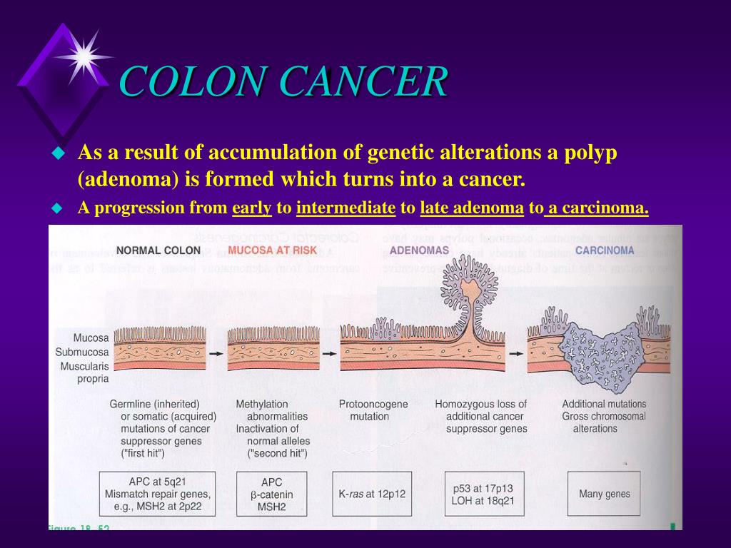 PPT - COLORECTAL CANCER PowerPoint Presentation, free download - ID:563571